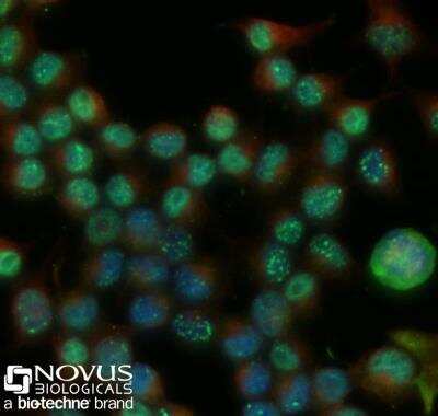 Neuro2a cells were fixed for 10 minutes using 10% formalin and then permeabilized for 5 minutes using 1X PBS + 0.5% Triton-X100. The cells were incubated with 53BP1 Antibody at 2 ug/mL overnight at 4C and detected with an anti-rabbit Dylight 488 (Green) at a 1:500 dilution. Alpha tubulin (DM1A) NB100-690 was used as a co-stain at a 1:1000 dilution and detected with an anti-mouse Dylight 550 (Red) at a 1:500 dilution. Nuclei were counterstained with DAPI (Blue). Cells were imaged using a 40X objective.